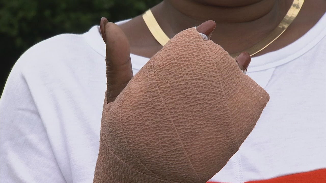 Asheville woman's finger bit off during fight with neigbor