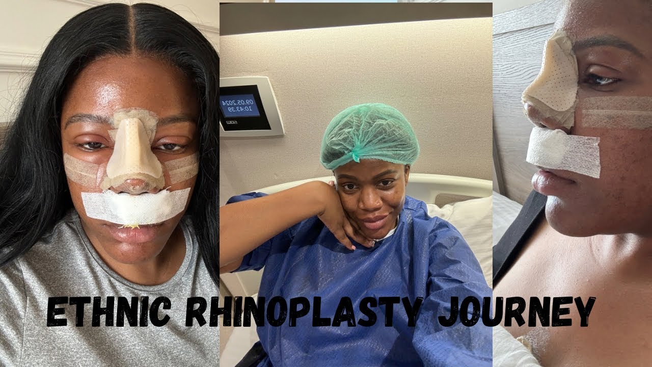 ETHNIC RHINOPLASTY WITH DR BORA.OK