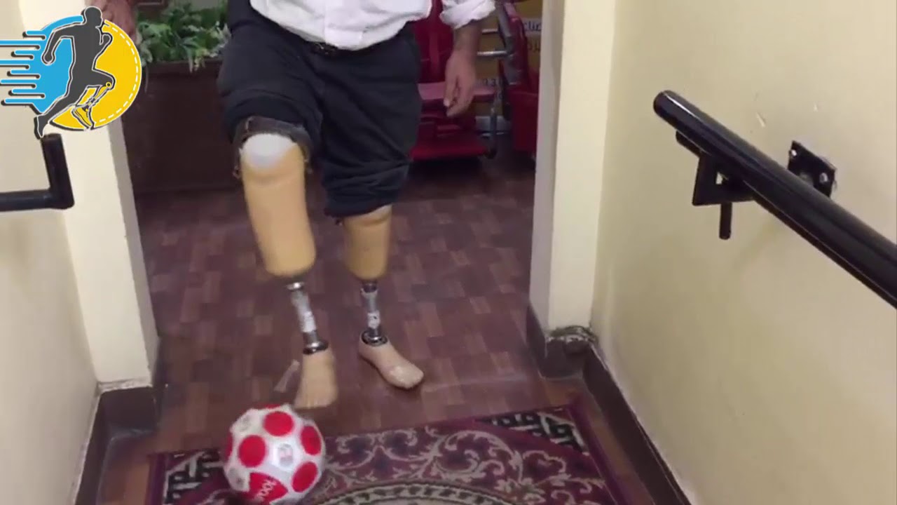 طرف صناعى بتر تحت الركبة حالة مزدوجة