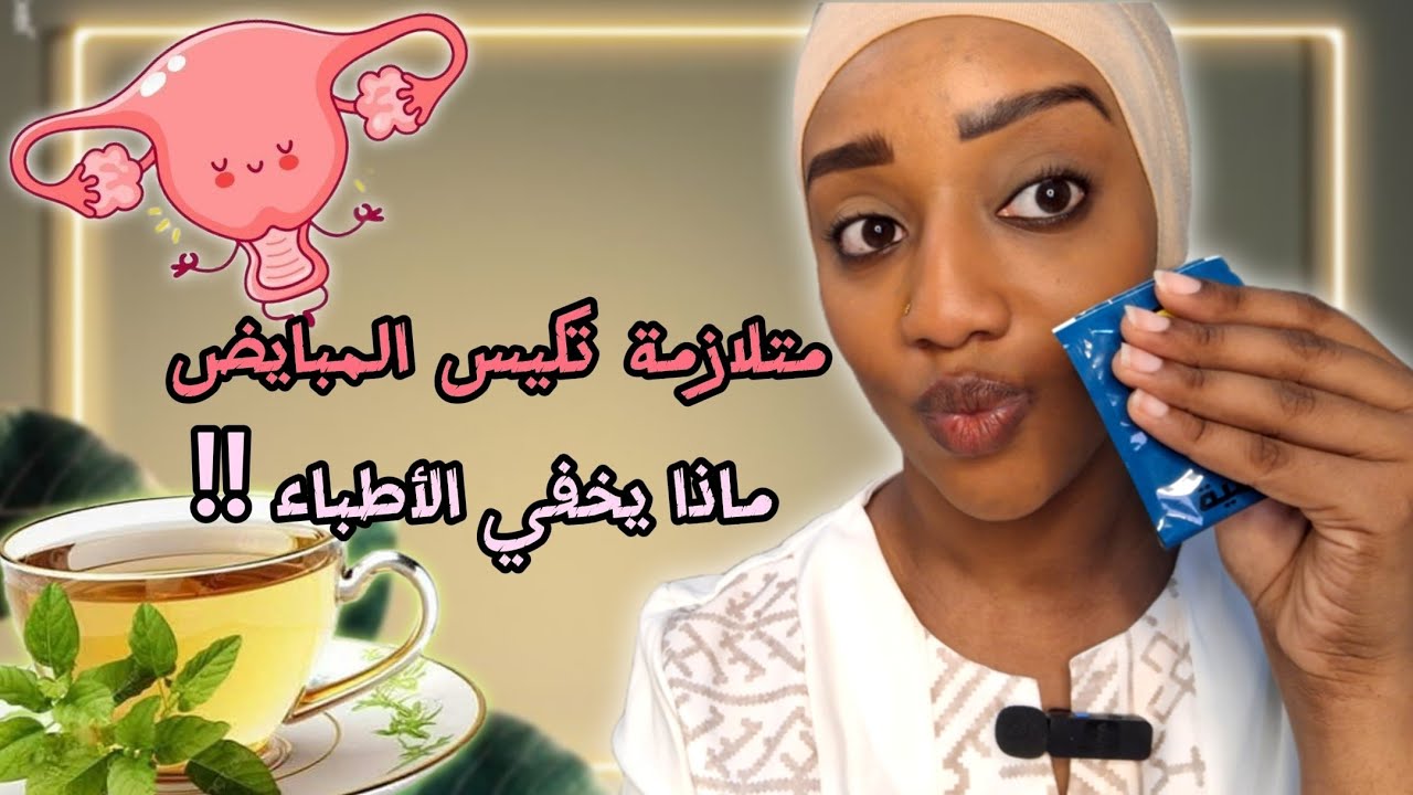 تكيس المبايض : ما لا يخبرك به الاطباء عن طبيعة جسمك