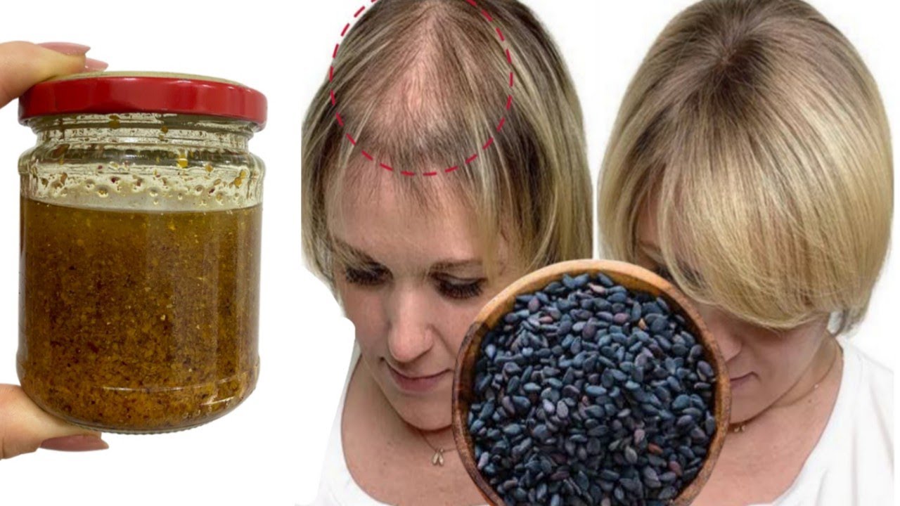 Индийский секрет 🌱 Волосы растут как сумасшедшие и не выпадают, лечит облысение,