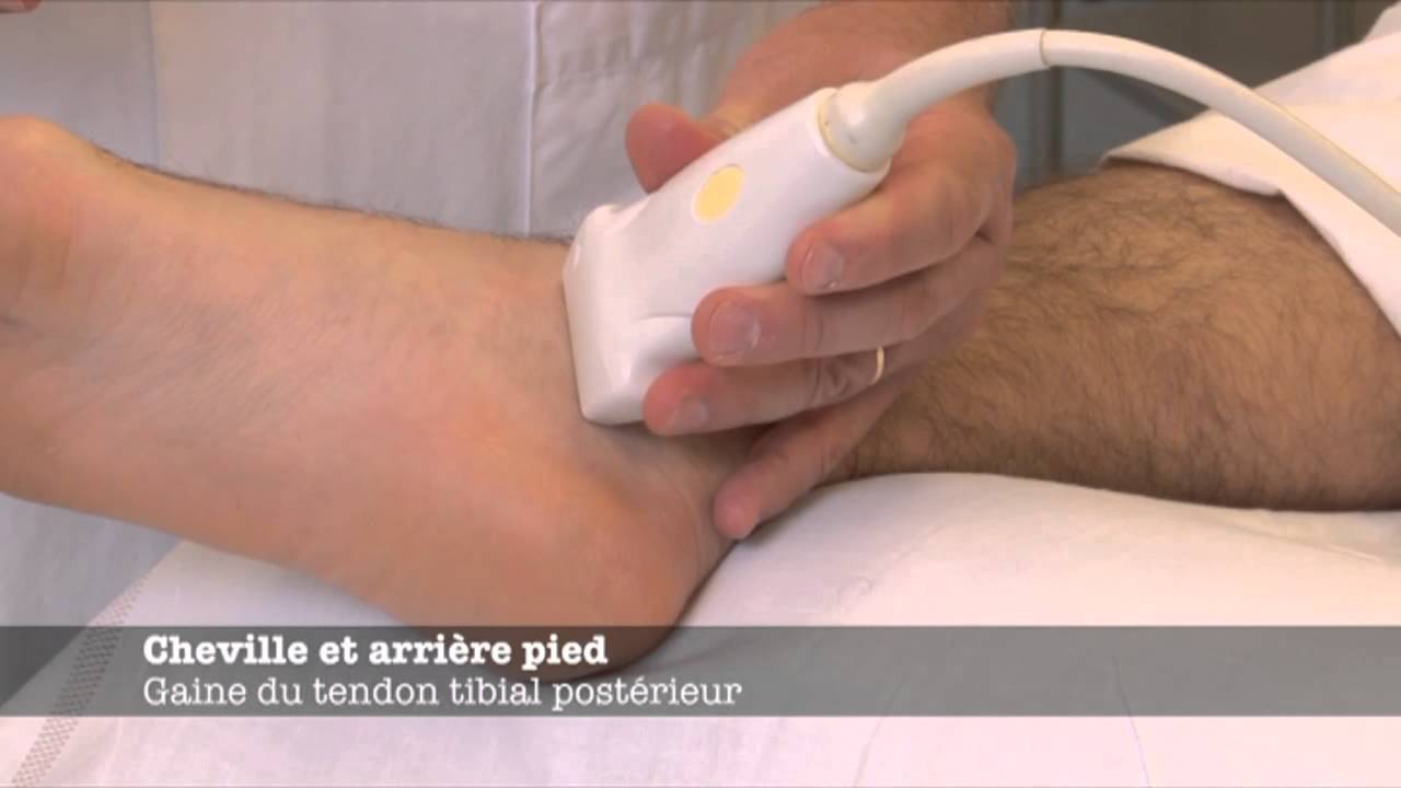Echoms.info - Gaine du tendon tibial postérieur