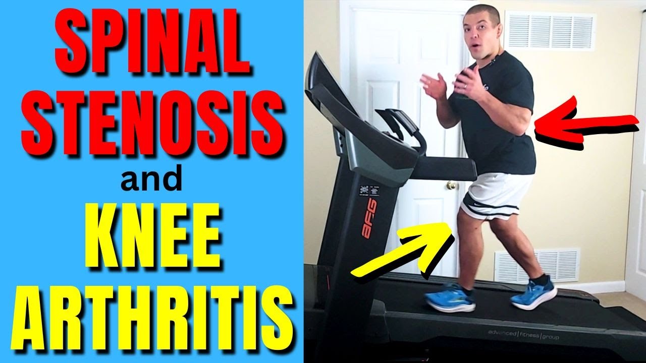 Surprising Benefits of Incline Treadmill Walking for Knee Arthritis & Spinal Stenosis