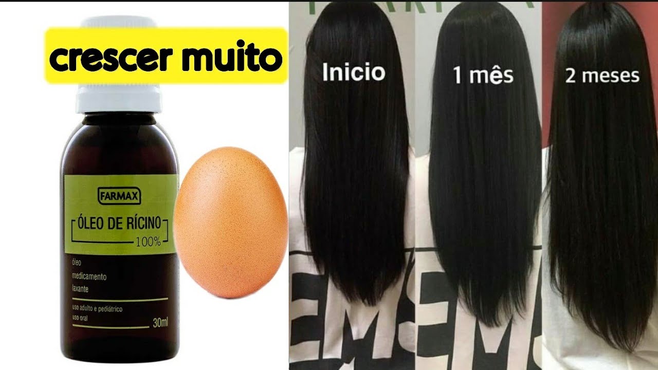 crescer cabelo mais rápido com ovos rícino !!  Desafio de crescimento de cabelo super rápido!