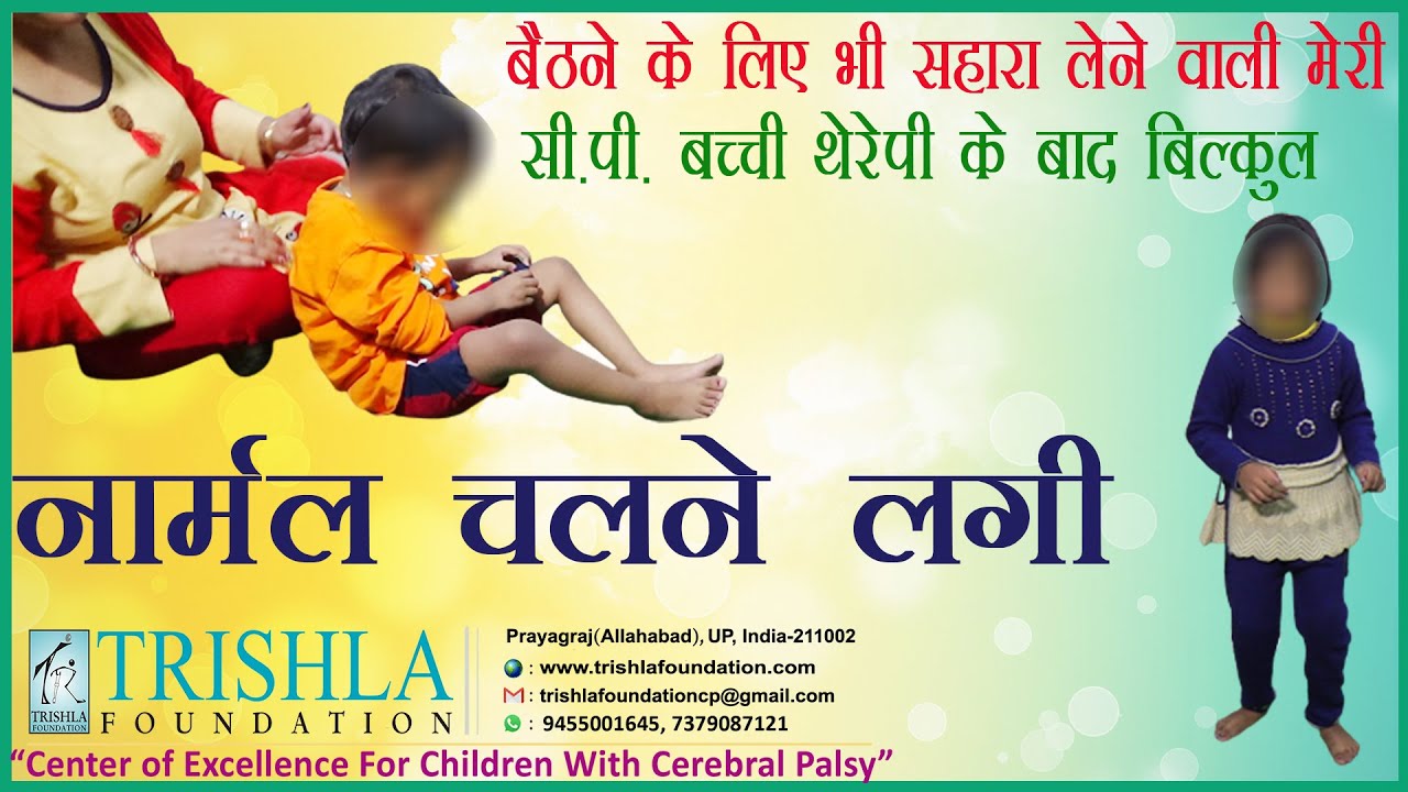 How Cerebral Palsy Physiotherapy Provided Excellent Recovery | Trishla Foundation [bangala]