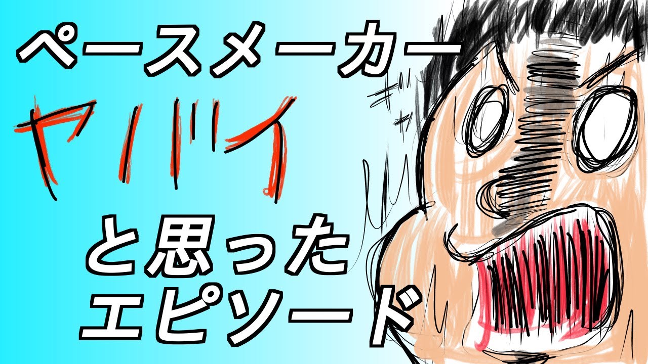 (不注意禁止)心臓ペースメーカーマンが日常生活でヤバイと思ったエピソード！(だいたい自分のせい)