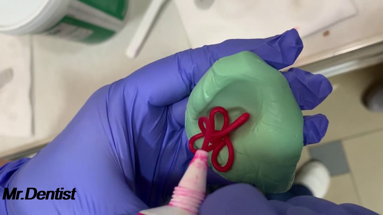 Dental Impressions Using a-silicons !!!