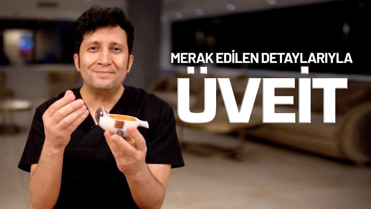 UVEİTİS, ÜVEİT