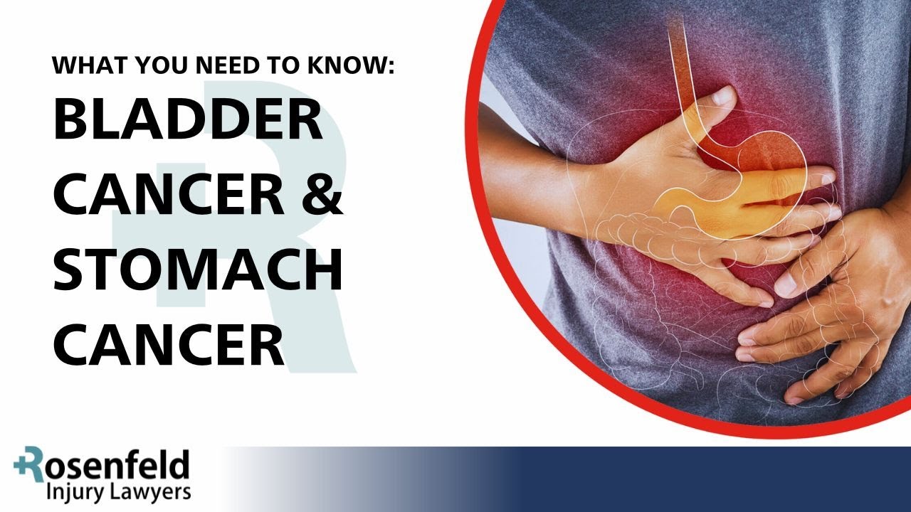 Zantac Cancer Lawsuits :: Bladder Cancer :: Stomach Cancer :: What You Need to Know