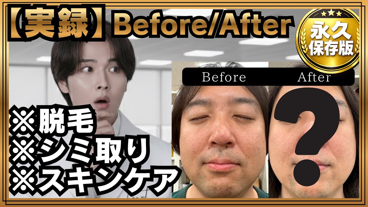 【1年間ガチ検証】肌検証した結果がすごい　かんたんメソッドで誰でも変われる