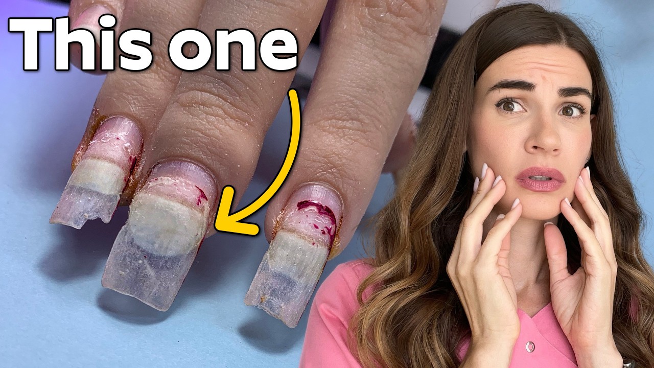 Why This Finger Got Rejected by a Salon