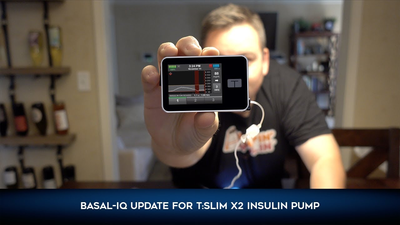 Scott has diabetes | Basal-IQ Update for t:slim X2 Insulin Pump