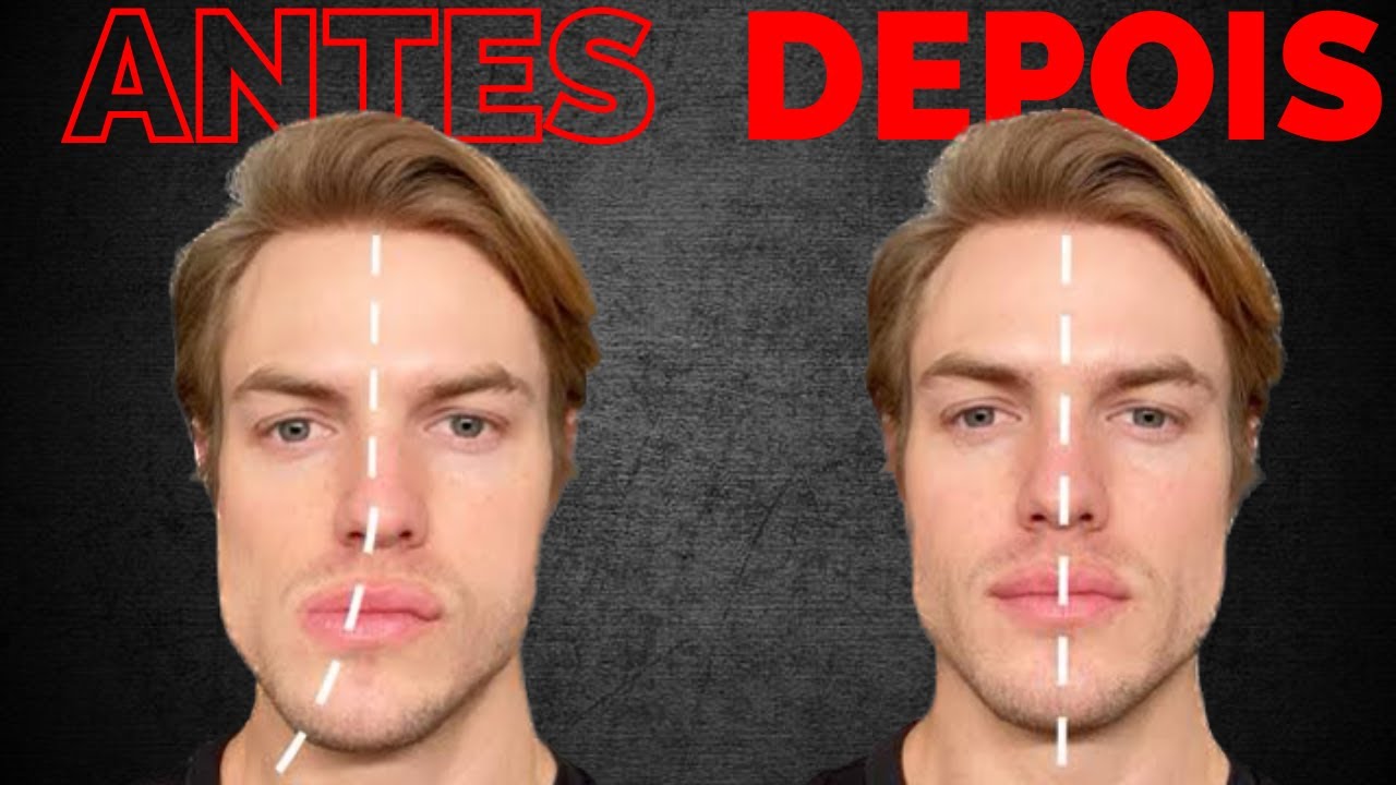 ASSIMETRIA FACIAL Como Corrigir com Exercícios (guia definitivo)