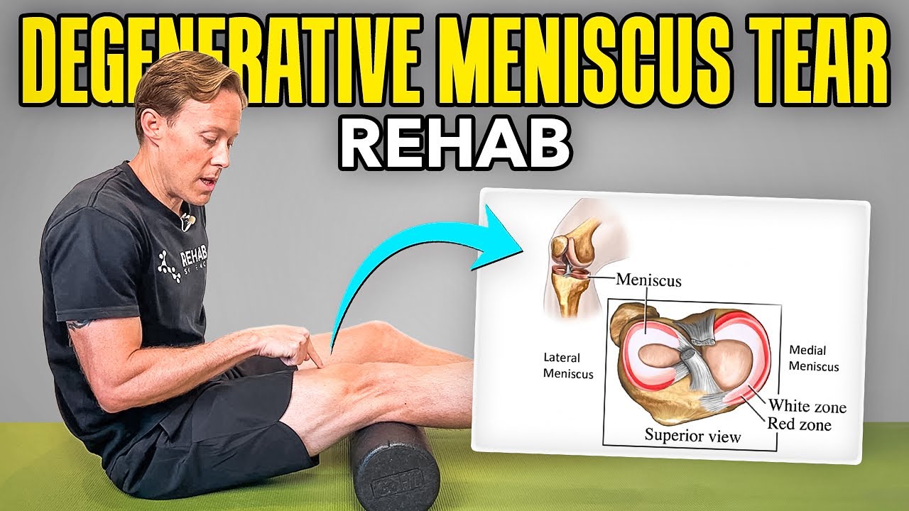 4 Rehab Exercises for a Degenerative Meniscus Tear