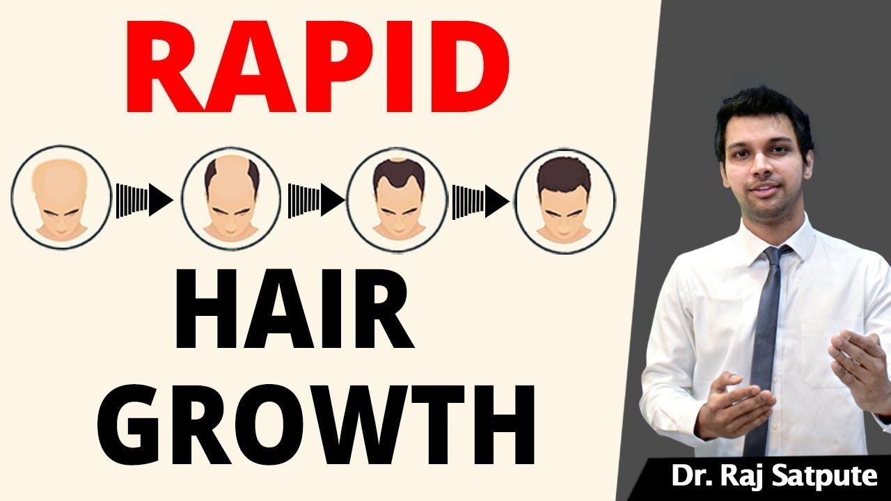 100% GUARANTED How To STOP HAIR LOSS NATURALLY & REGROW HAIR FASTER Without MEDICINES | Men & Women
