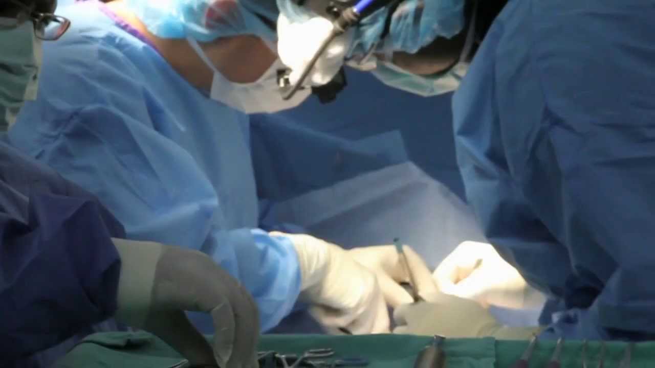 Less is More For Lymph Node Removal