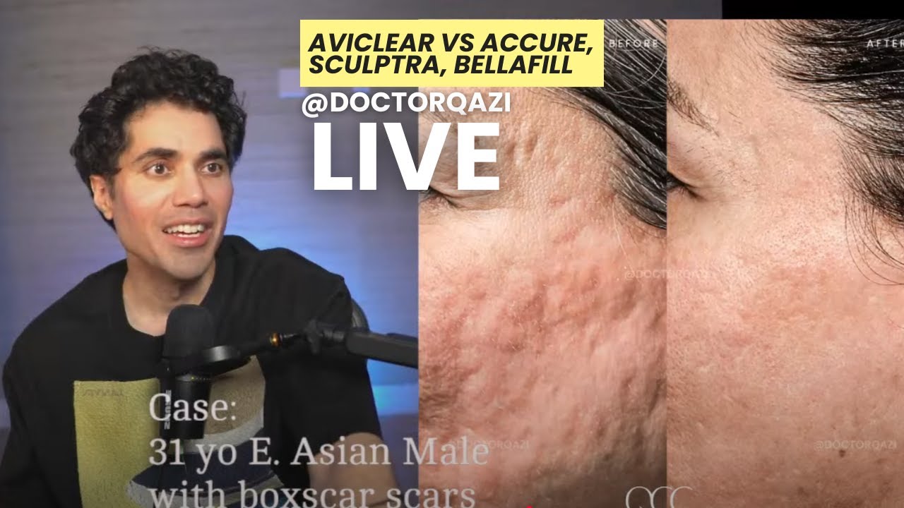 Доктор Кази обсуждает AviClear против Accure, Sculptra и Bellafill | Неспонсируемый прямой эфир д...