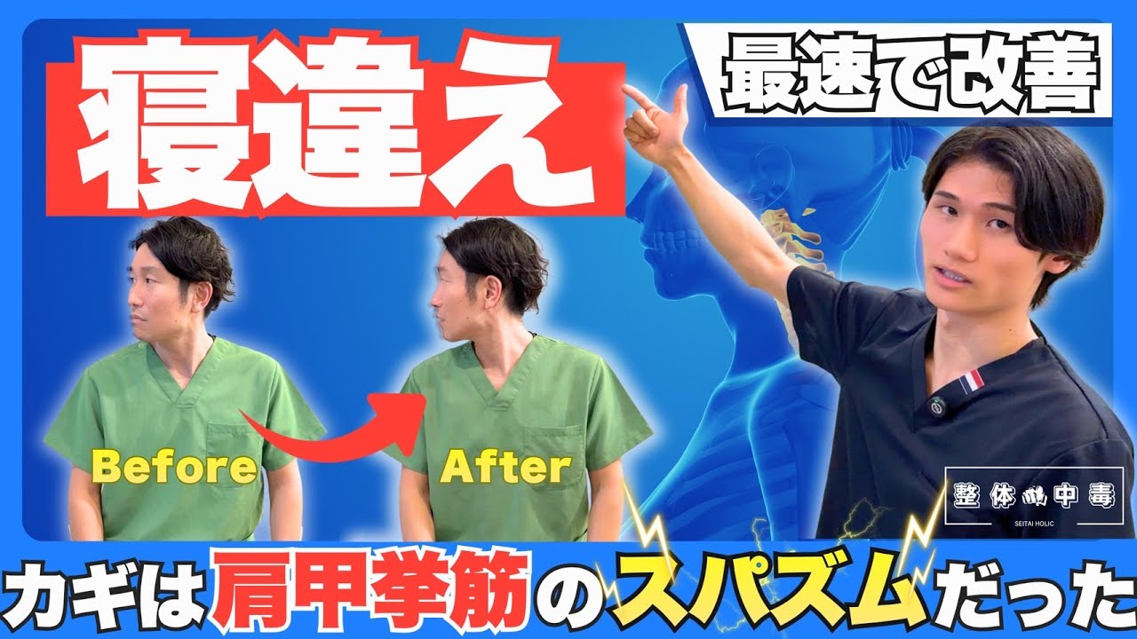 【寝違え】寝違え施術で劇的変化を求める先生へ！寝違えの根本原因であるスパズムを理解して肩甲挙筋の評価からアプローチまでを全て解説！寝違え施術はこの動画で完結！#整体　#整体師　#整骨院　 #寝違え