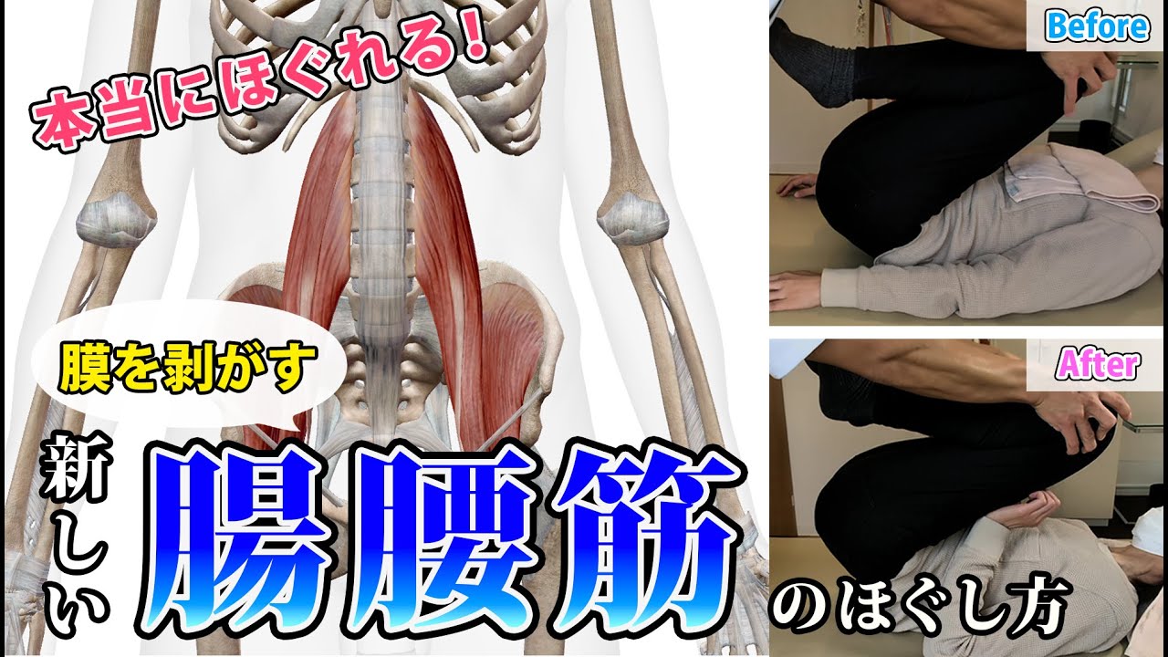 腰痛改善で腸腰筋をほぐしたければ押さない、揉まない「剥がす」