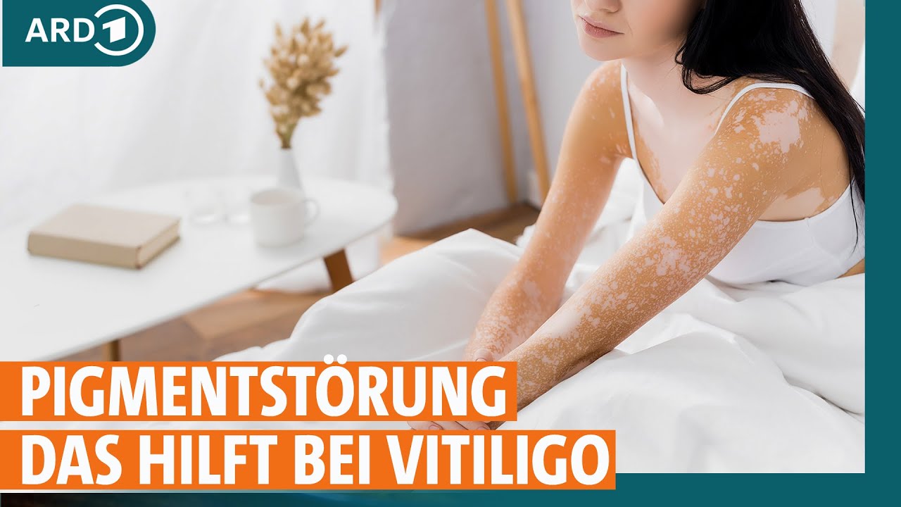 Neue Behandlungsmethoden bei Vitiligo | ARD Gesund