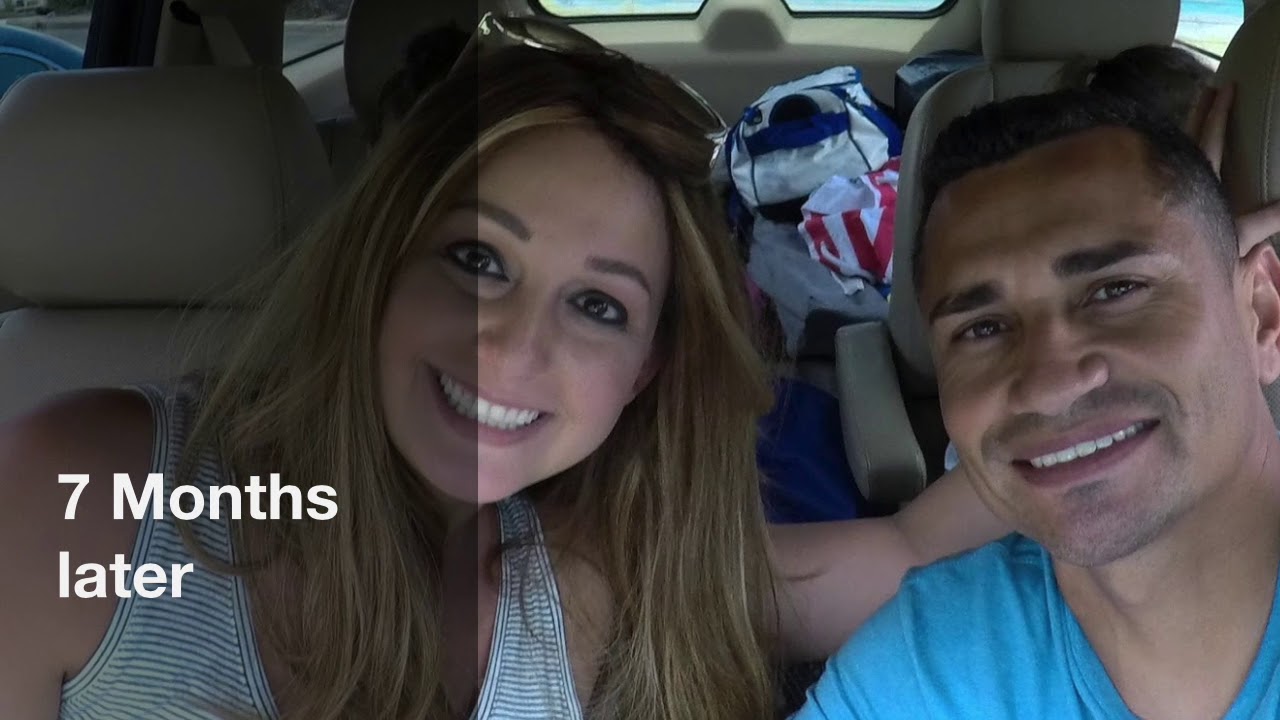 Alopecia hair update, Hairalicious 3