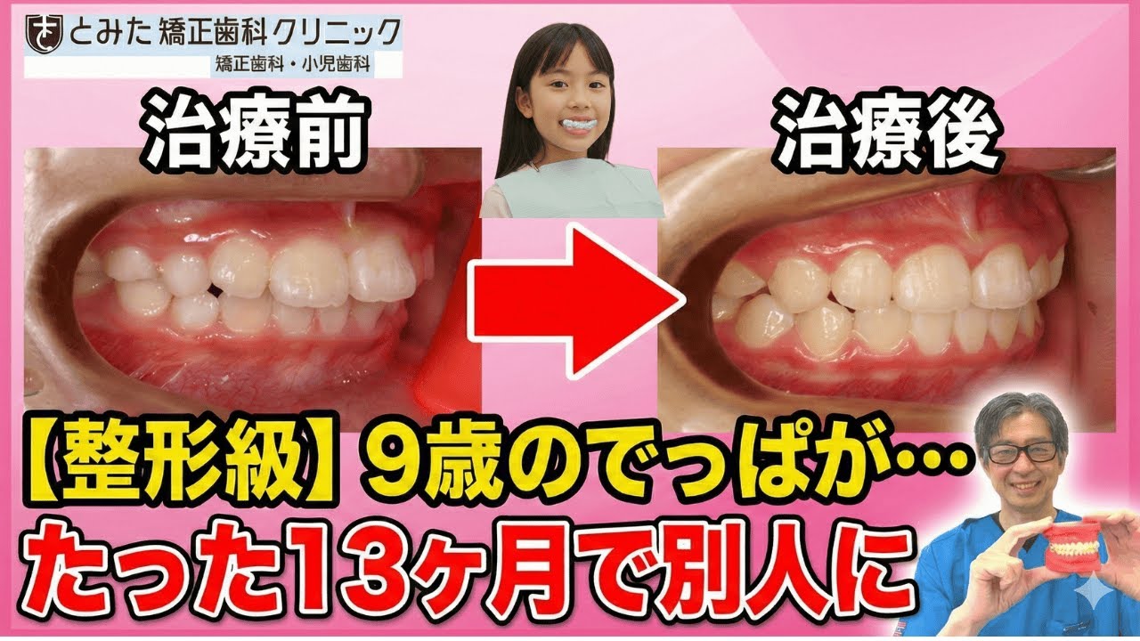 有料級！マウスピースで激変する子・しない人の差。知らないとマジでヤバい
