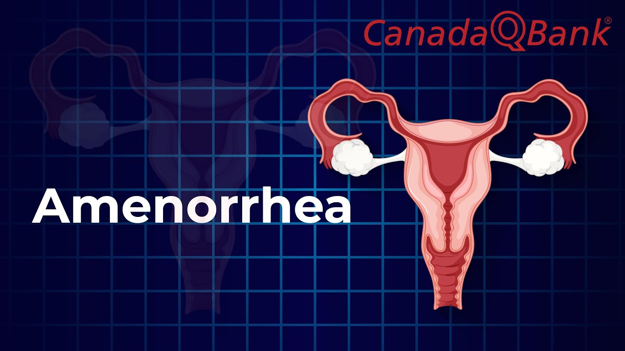 Amenorrhea Explained | Primary vs Secondary, Causes & Workup | CanadaQBank