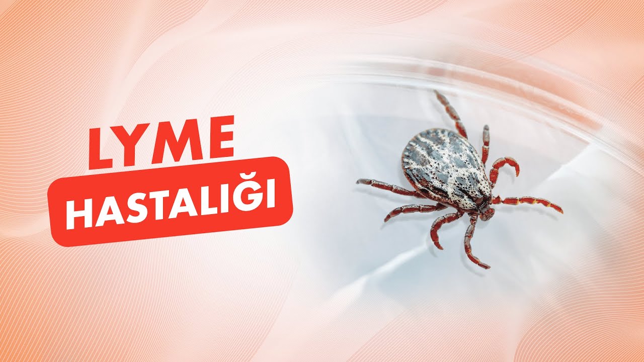 Lyme Hastalığı Nedir? Kene Isırması Sonrası Lyme Hastalığı Nasıl Anlaşılır?