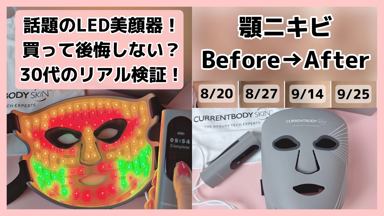 話題のLED美顔器！買って後悔しない？30代のリアル検証！ビフォアフ比較