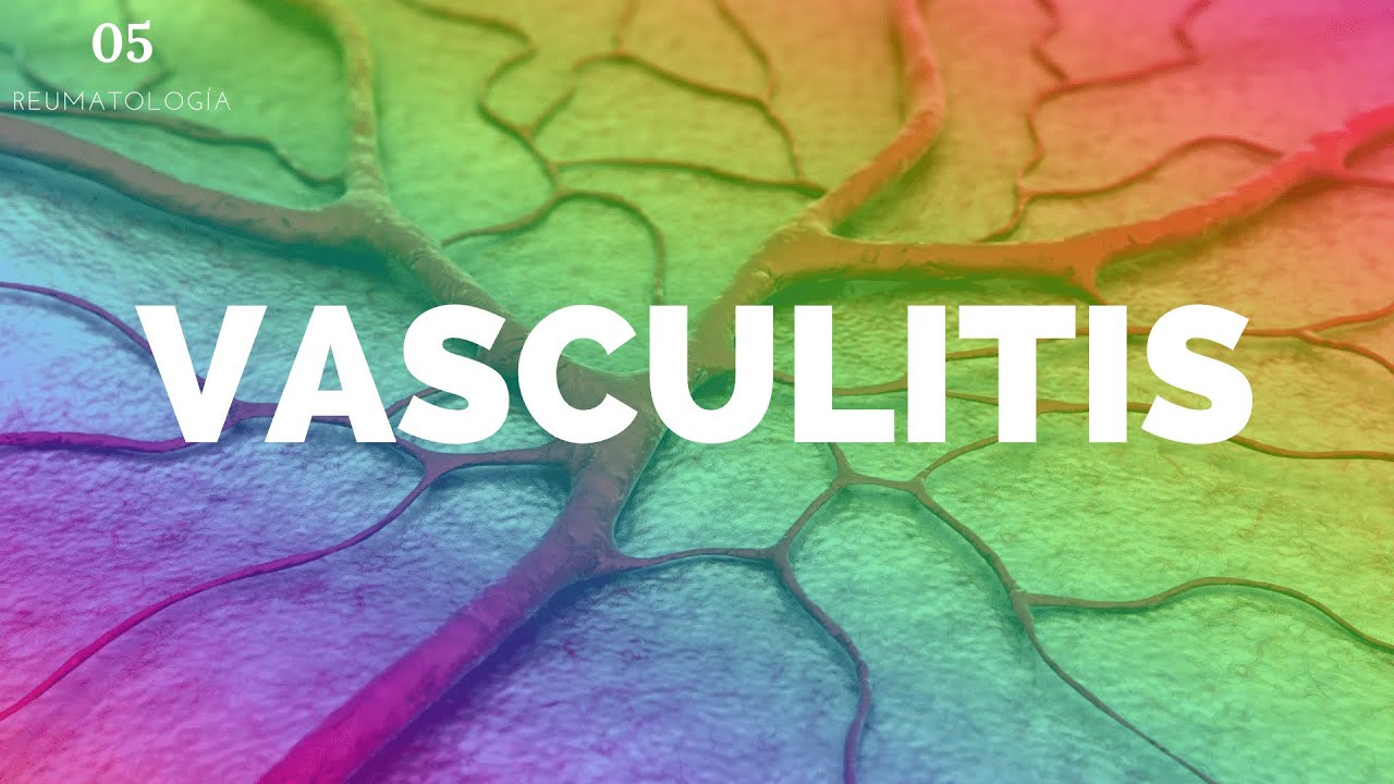 Vasculitis (A DETALLE) - ENARM