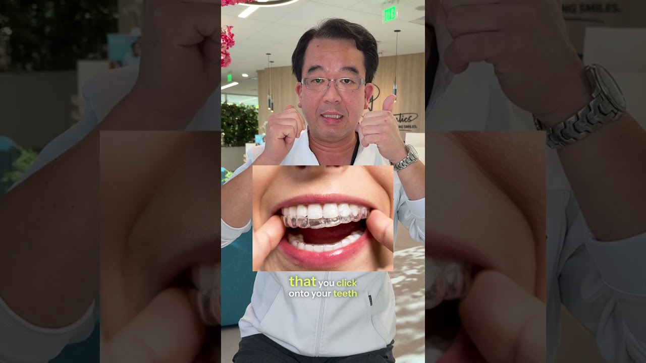 Do you need a permanent retainer? Watch this! #orthodontist #braces #retainer