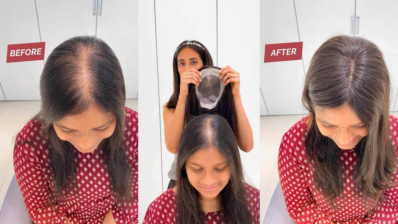 Monotop Hair Toppers | Hair Toppers For Hair Thinning | Human Hair Toppers India by 1 Hair Stop