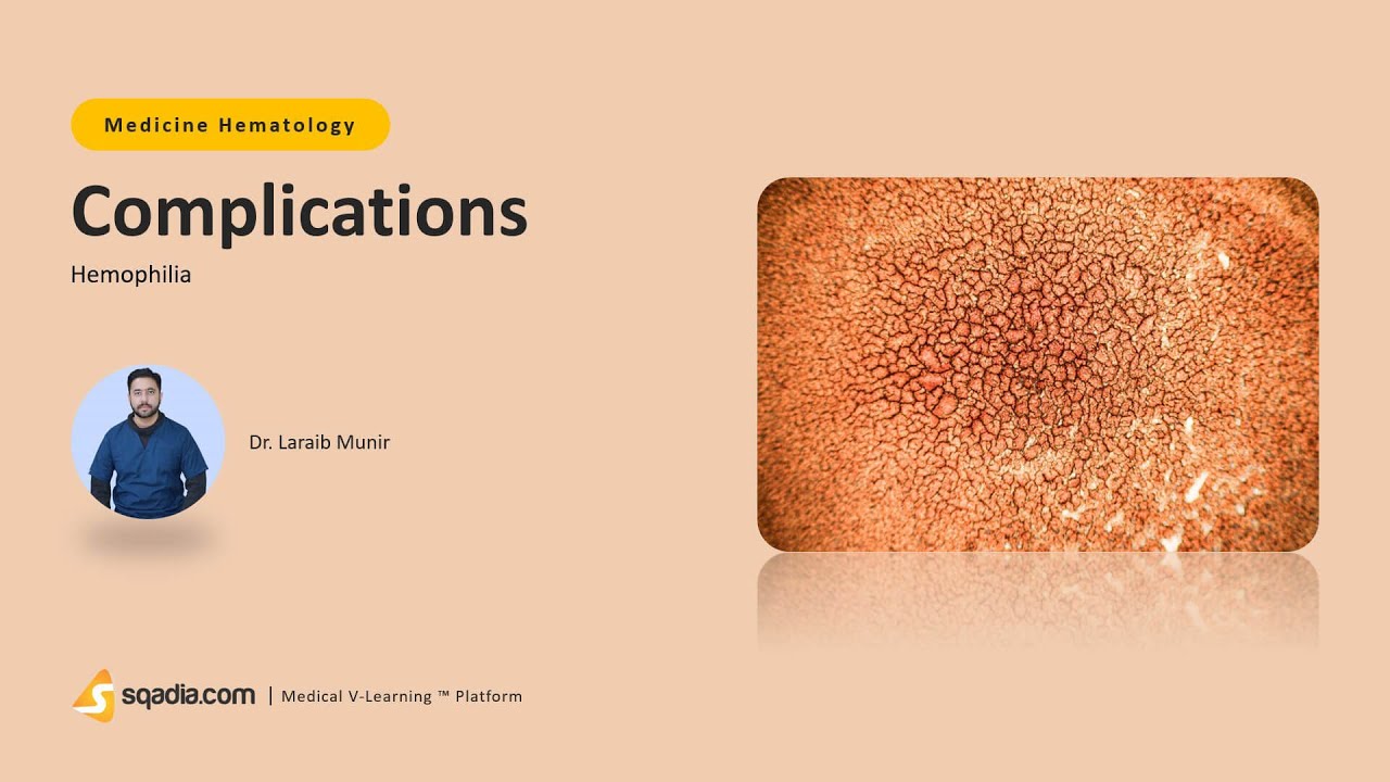 Hemophilia | Complications