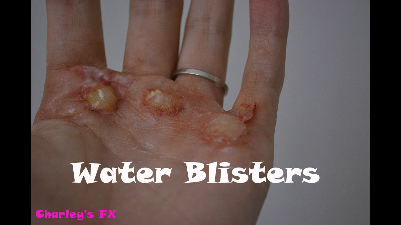 Water Blister SFX makeup