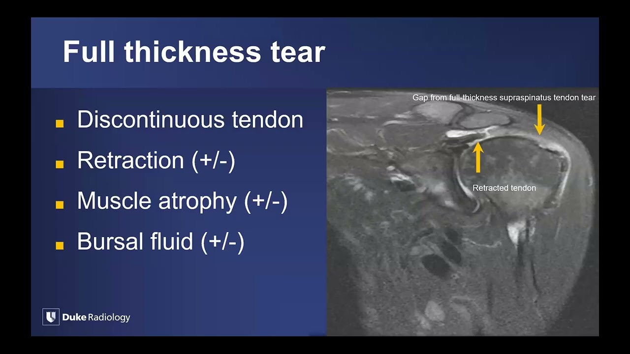 Expanding the Field: Imaging of Sports-Related Injuries Beyond the Knee - Sample