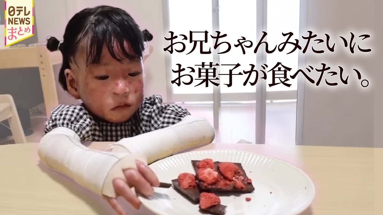 &rdquo;難病の少女&rdquo; のために医師が作ったチョコ / なぜ私が&hellip;若年性認知症と共に生きる人々 など【知ってほしい私のこと】（2025年傑作選）