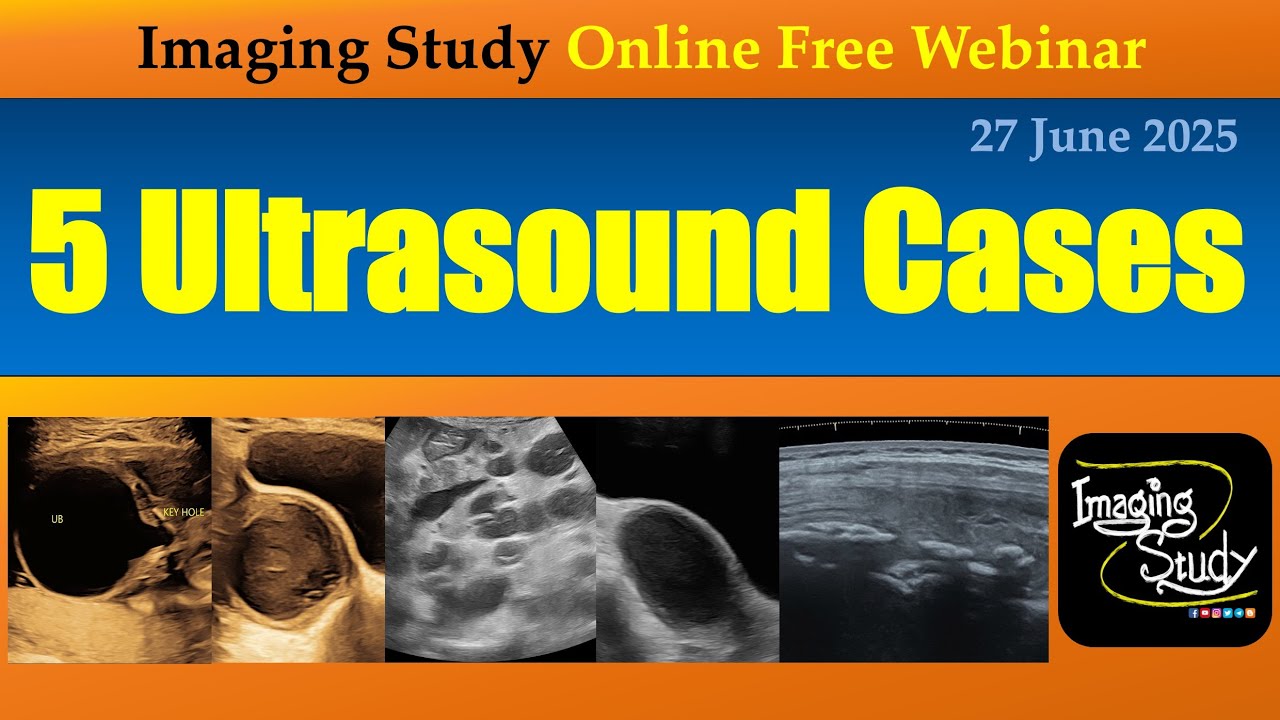 5 Ultrasound Cases || Imaging Study || 27 June 2025 || Online Webinar