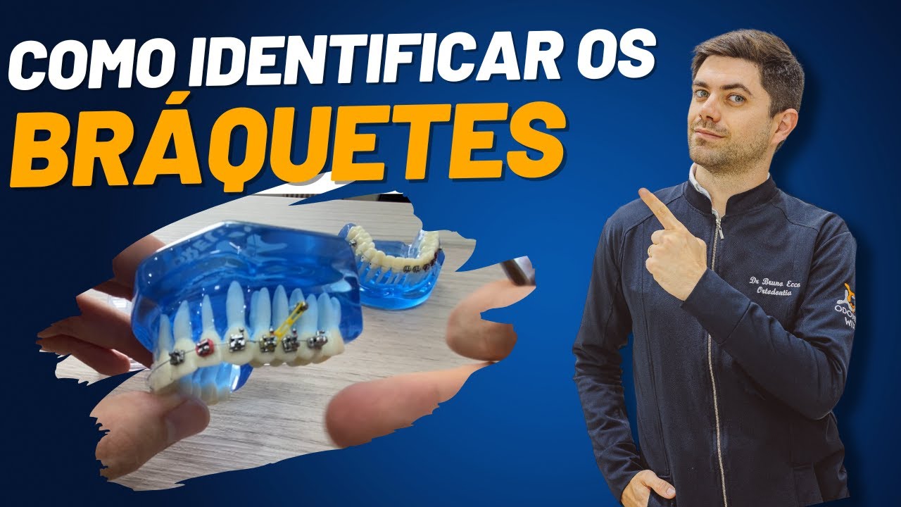 COMO IDENTIFICAR BRÁQUETES | ASB TOTAL