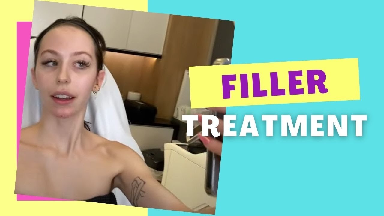 PROFILE BALANCING WITH FILLER TO PROJECT THE CHIN IN YOUTHFUL FEMALE WITH GREAT LIPS | DR JASON EMER