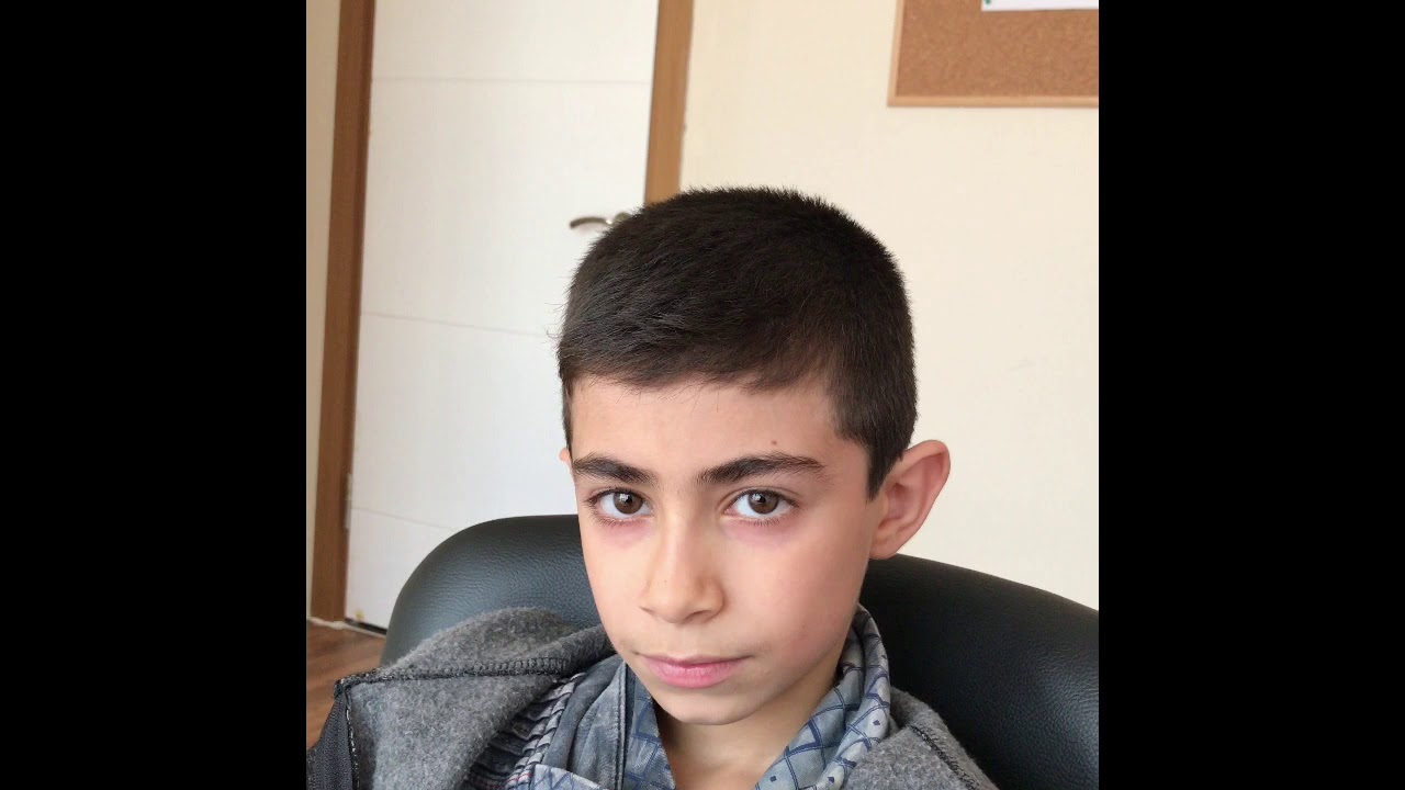 En Korkulan Ses R Sesi Ve Sadece 5 Seansta Gelinen Nokta