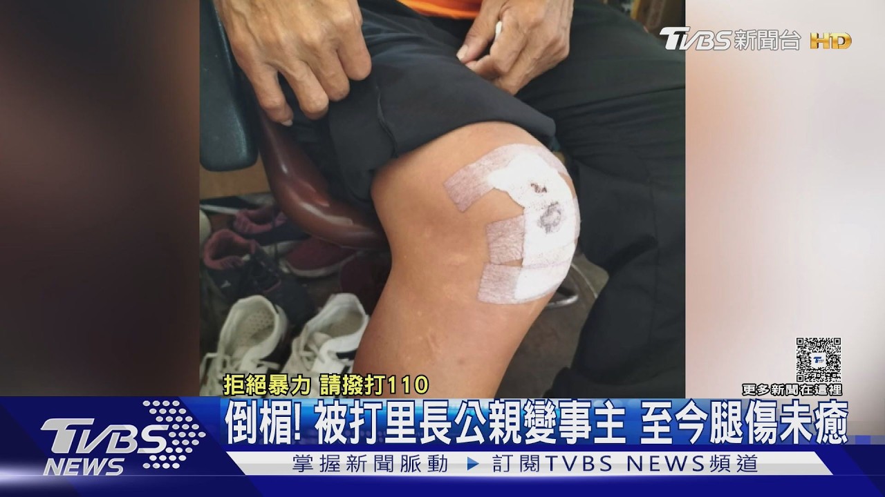獨／公親變事主! 倒楣被打里長3年多腿傷未癒　連任被迫中斷｜TVBS新聞 @TVBSNEWS01