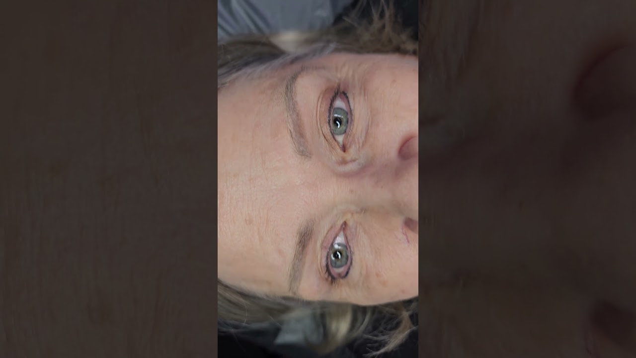 Healed Microshading Aged 2 years 