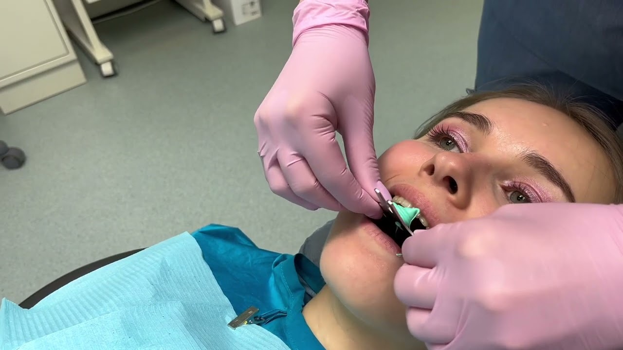 Учебный фильм «Лицевая дуга»