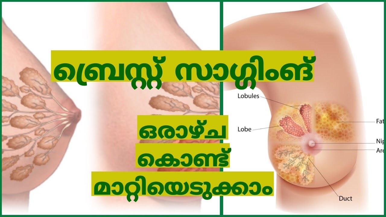 ബ്രെസ്റ്റ് sagging ഒരാഴ്ച കൊണ്ട് മാറ്റിയെടുക്കാം
