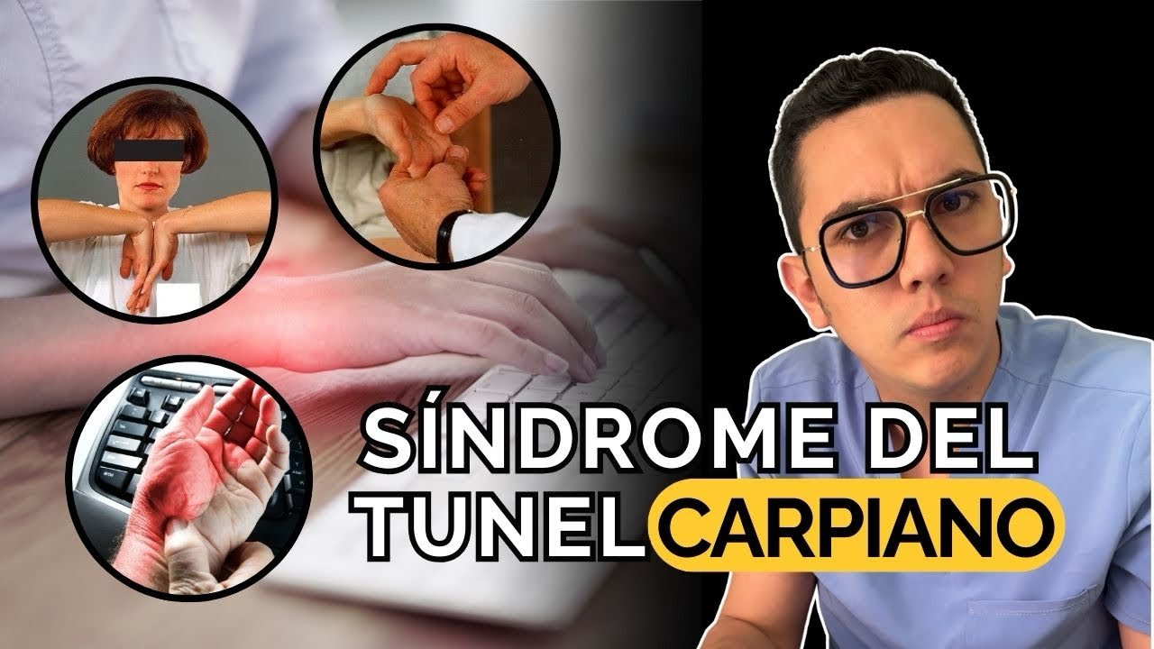 Señales de alerta de que tienes síndrome del túnel carpiano | Dr. William Guerrero