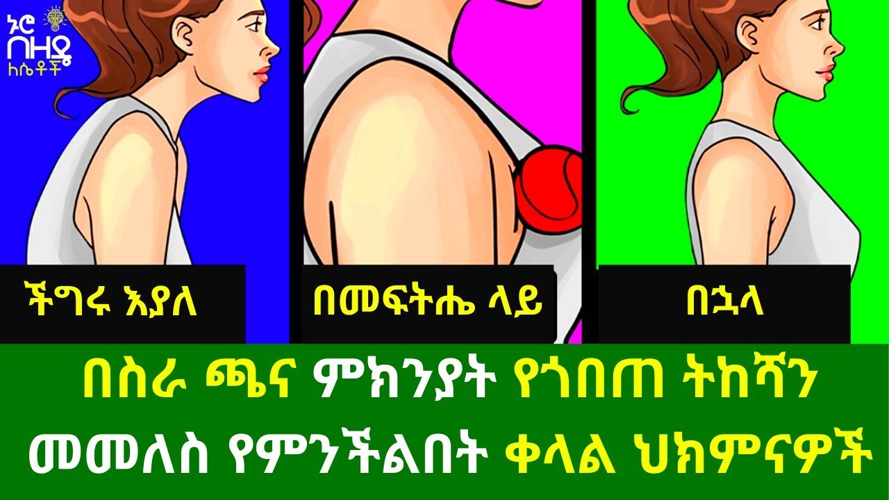 Ethiopia:- በስራ ጫና ምክንያት የጎበጠ ትከሻን መመለስ የምንችልበት ቀላል ህክምናዎች - ከጤና ባለሙያ | Nuro Bezede Girls