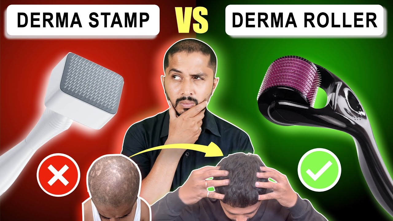Derma Roller vs Derma Stamp for Hair Growth: Which is Better? How to Use