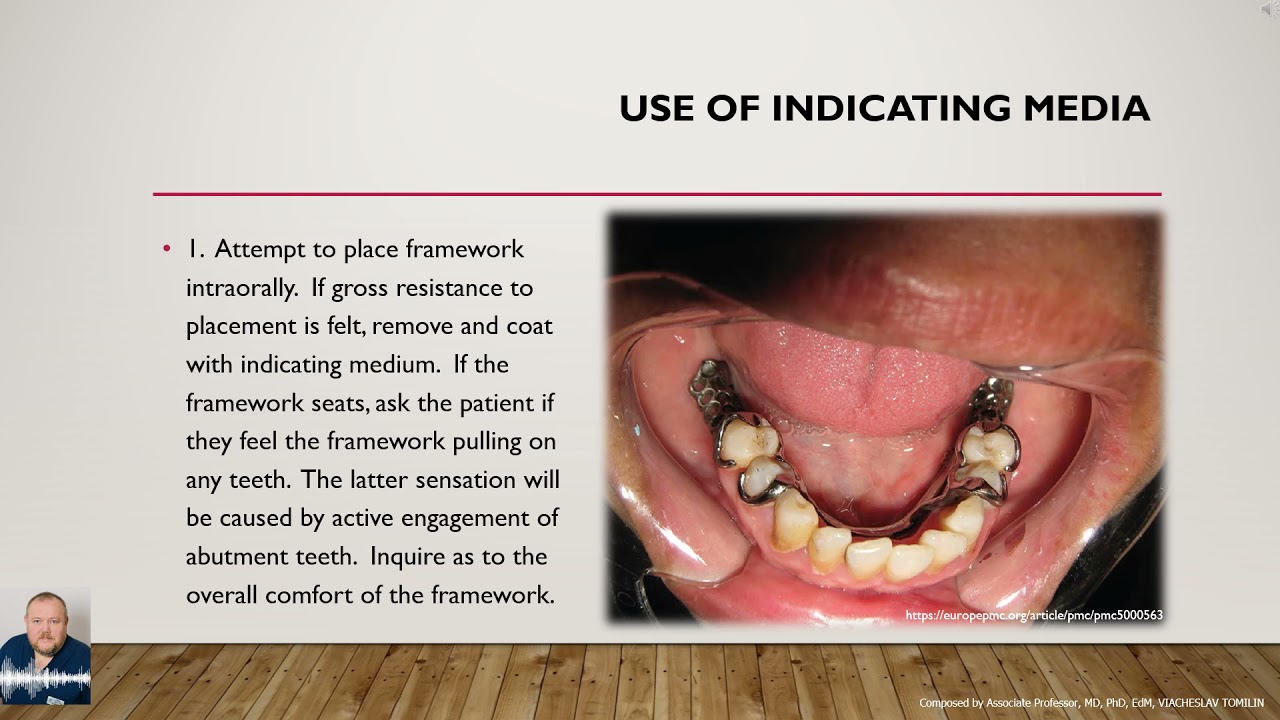 Removable Partial Denture Adjustment