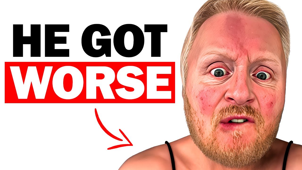 Instagram Reels Biggest Creep