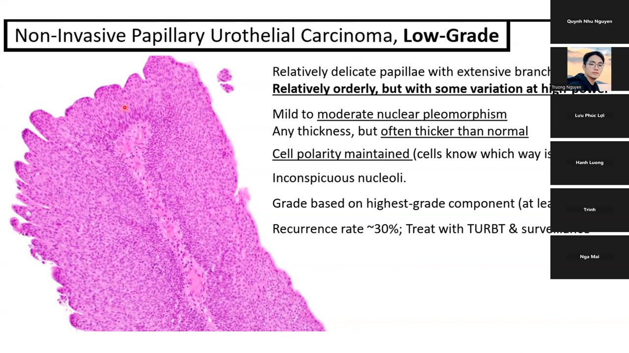 JCS 24. Molecular classification of urothelial bladder carcinoma
